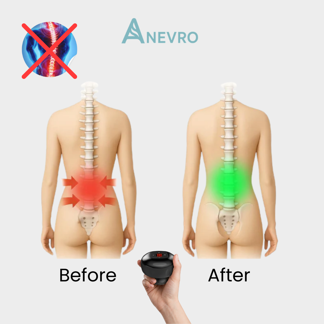 Anevro™ Red Light Cupping Therapy Device - 15 minutes a day to a pain-free life
